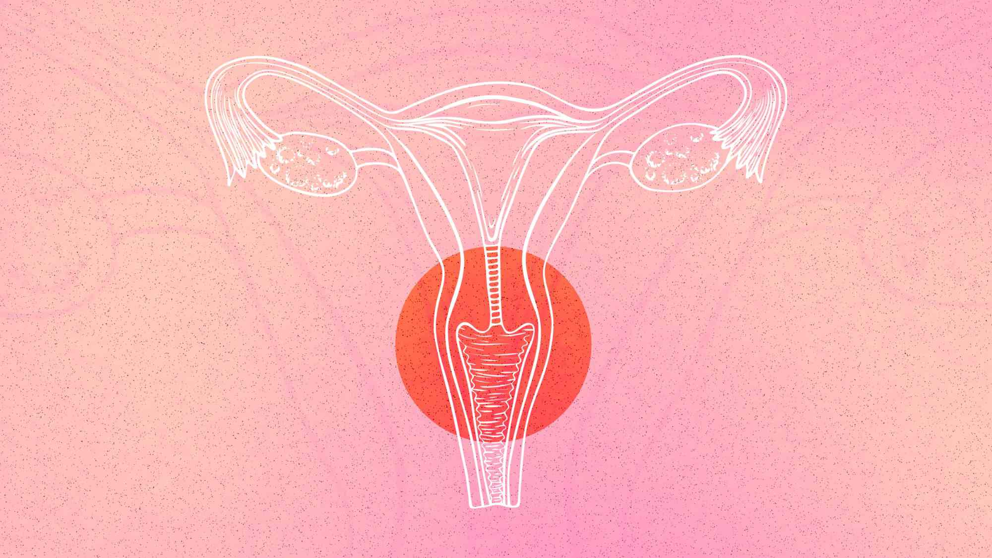 Post-Cancer Vaginal and Vulvar Symptoms: What to Expect and How to Find Relief